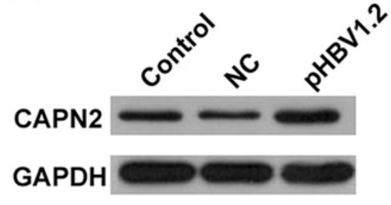 CAPN2 protein level in HepG2.jpg